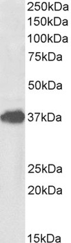 HDAC6 Antibody