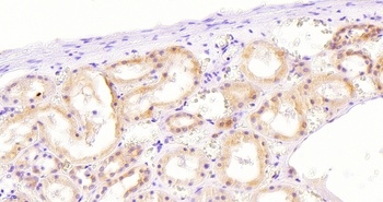 TGFBR1 Antibody