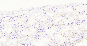 TGFBR1 Antibody