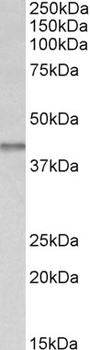 TGFBR1 Antibody