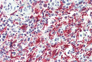AIF1 Antibody