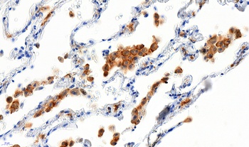 AIF1 Antibody