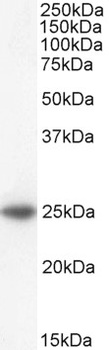 BAK1 Antibody