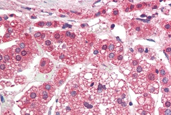 Psp Antibody