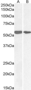 POLDIP2 Antibody