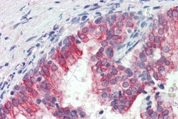 CST8 Antibody