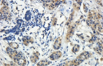 DYDC1 Antibody