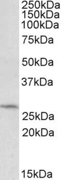 TGFBI Antibody