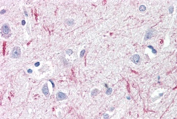 RARS Antibody