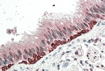 DIXDC1 Antibody