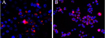 GPI Antibody