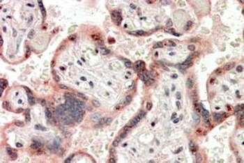 DTX3 Antibody