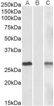 DTX3 Antibody