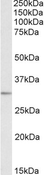SLC4A11 Antibody