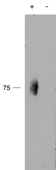 KCNN2 Antibody