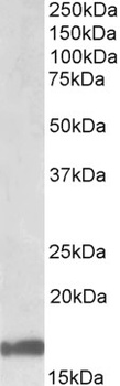 SLCO1B3 Antibody