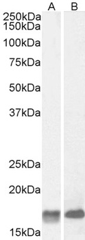 PROKR2 Antibody