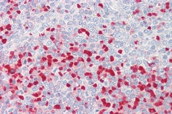 PROKR2 Antibody