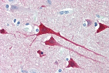 GAL Antibody