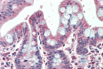 PFKFB2 Antibody