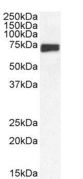 NEFM Antibody