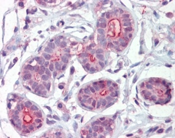 DAPK2 Antibody