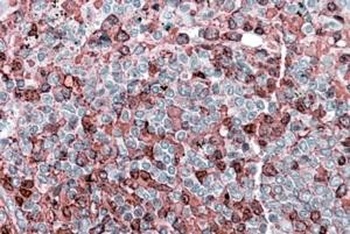 DSG1 Antibody