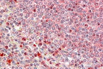 PRKCDBP Antibody