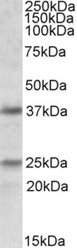 PRKCDBP Antibody