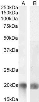 PREX1 Antibody