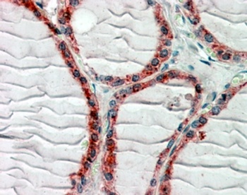 CXCL2 Antibody