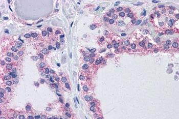 CLEC4C Antibody