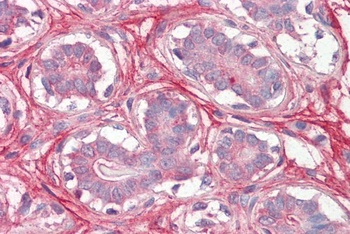 TRPC4AP Antibody