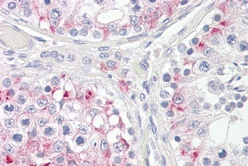 NCE2 Antibody