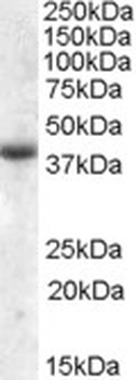 CPT1C Antibody