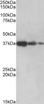 KIF6 Antibody