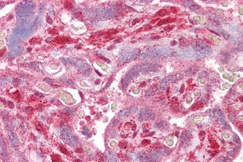 CDKN2A Antibody