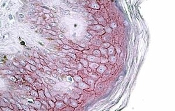 TNFSF14 Antibody