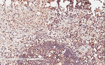PKD2 Antibody