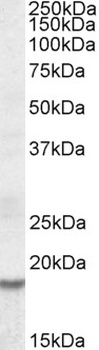 ICOS Antibody