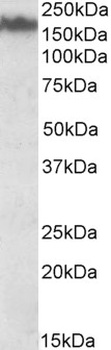 ICOS Antibody
