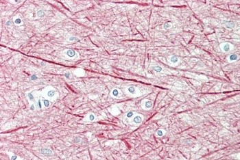 ICOS Antibody