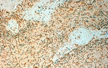 ICOS Antibody