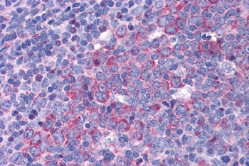 FAS Antibody