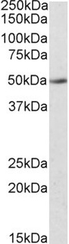 HMGA1 Antibody