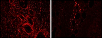 CLIP1 Antibody