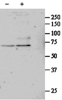 CLIP1 Antibody
