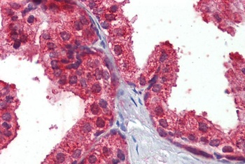 JAM2 Antibody