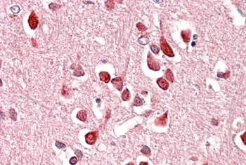 CLEC16A Antibody