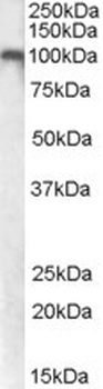 RBM3 Antibody